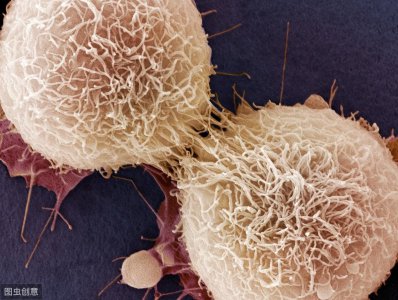 ​海拉细胞——源自宫颈癌的不死细胞！