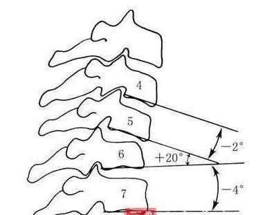 古天乐“颈椎移位”赴美手术，并告诫 “病向浅中医”